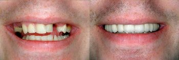 Smile Gallery - Integra Dental, Chicago Dentist